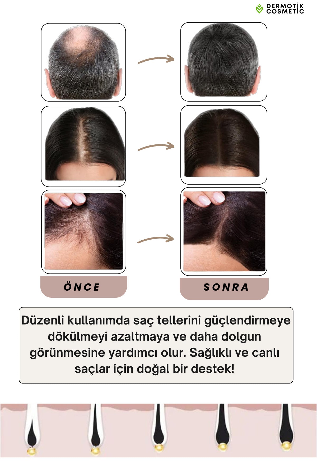 540 İğneli Titanyum Dermaroller 0.5 mm & Dezenfektan Seti
