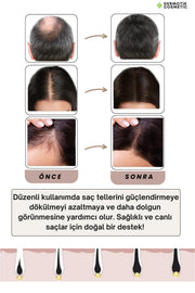 540 İğneli Titanyum Dermaroller 0.5 mm & Dezenfektan Seti