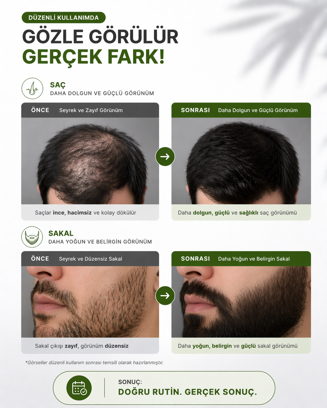 Saç Sakal Oluşumuna Yardımcı Sakal Serum Seti Besleyici Ve Dolgunlaştırıcı Serum
