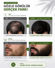 Saç Sakal Oluşumuna Yardımcı Sakal Serum Seti Besleyici Ve Dolgunlaştırıcı Serum