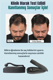 540 İğneli Titanyum Uçlu 0.75 mm Seyrek Saç ve Yüz Bakım Dermarolleri - kullanım ve ürün detayı