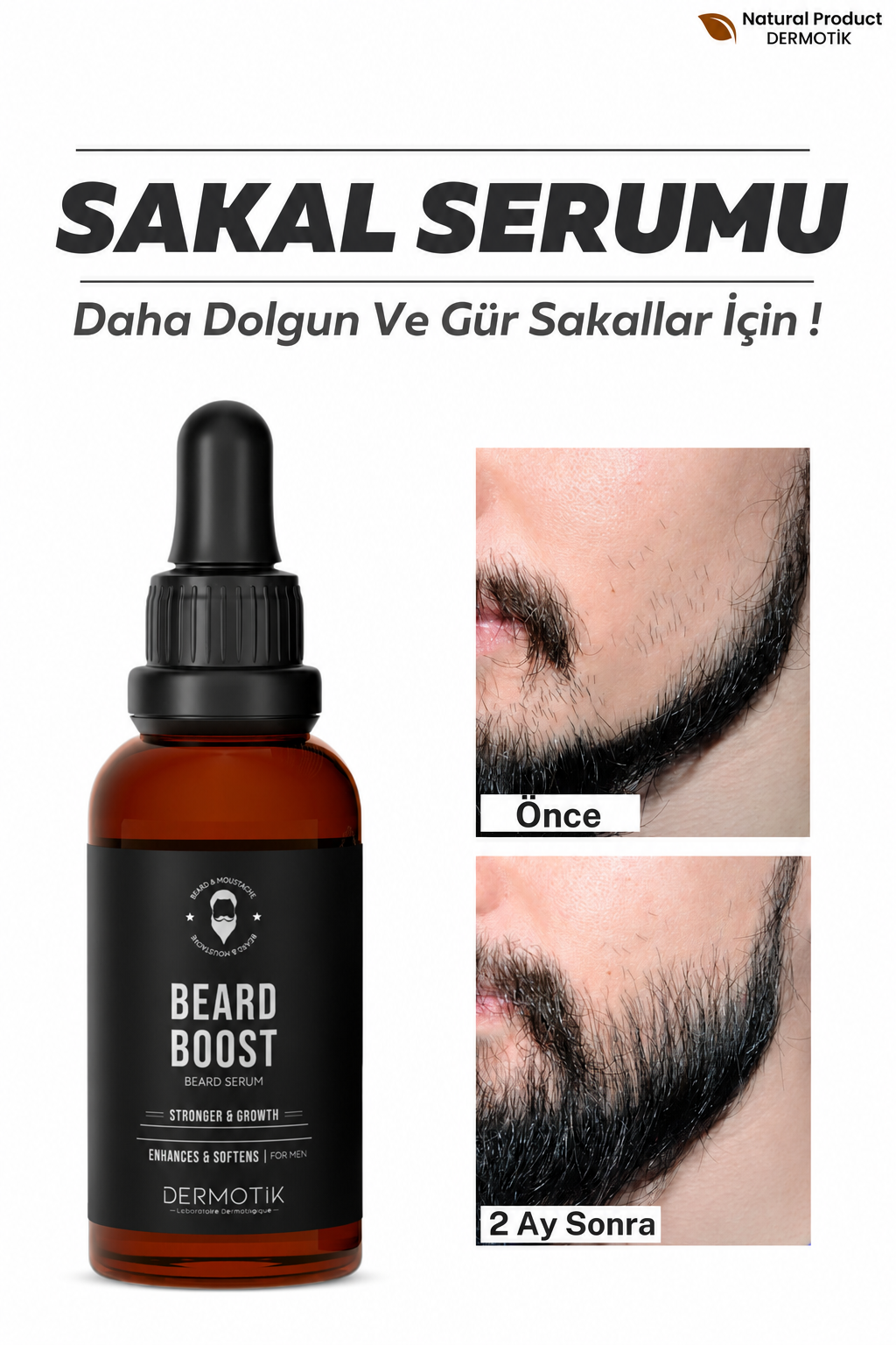 Seyrek Saç Ve Sakal İçin Dolgunlaştırıcı Bakım Serum – 10 Farklı Yağ İçeren Özel Formül 30 ml