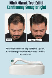 540 İğneli Titanyum Dermaroller 0.5 mm & Dezenfektan Seti