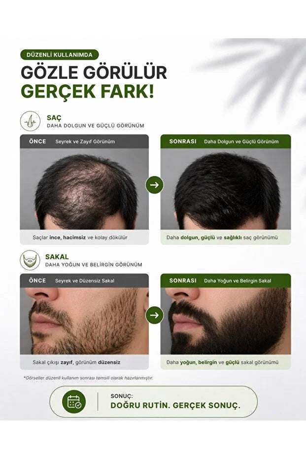 540 İğneli Titanyum Dermaroller 1 mm & Dezenfektan Seti
