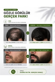 540 İğneli Titanyum Dermaroller 1 mm & Dezenfektan Seti