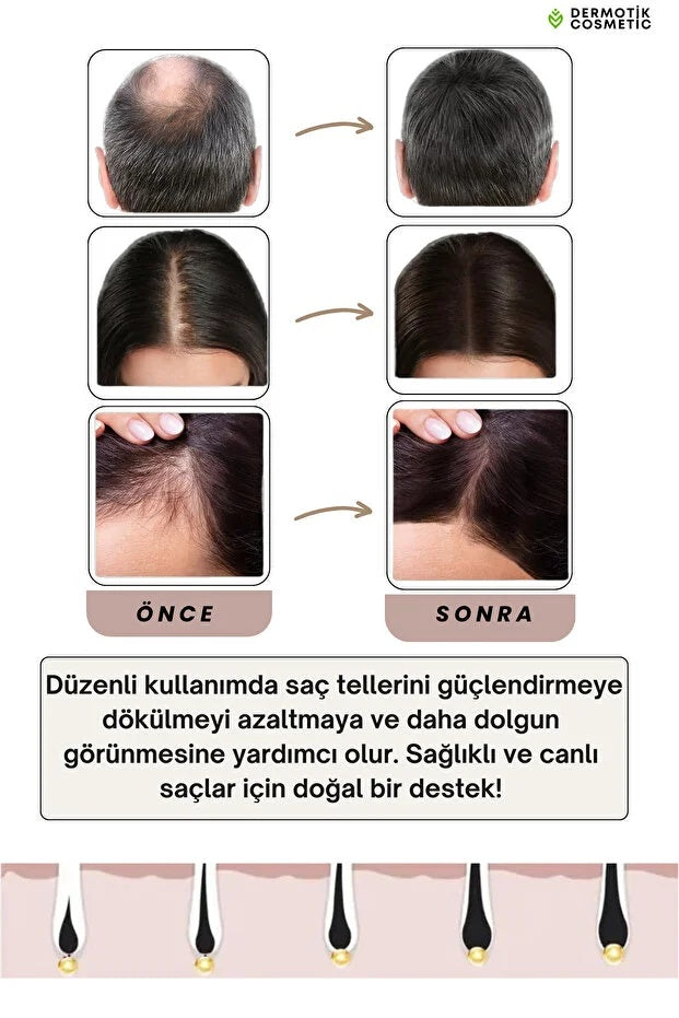 540 İğneli Titanyum Dermaroller 1 mm & Dezenfektan Seti