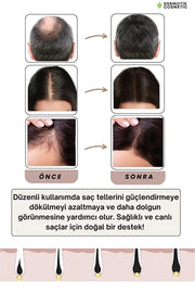 540 İğneli Titanyum Dermaroller 1 mm & Dezenfektan Seti