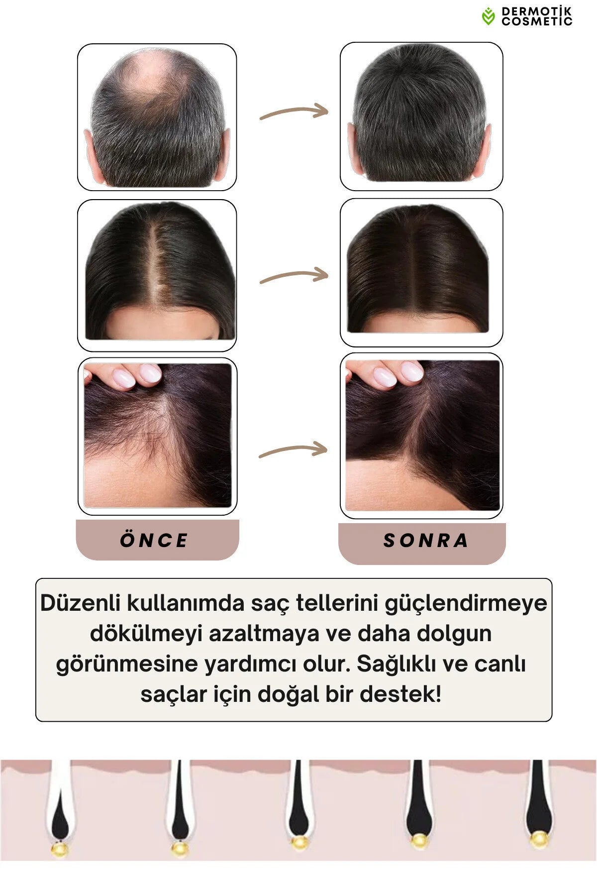 Biberiye Suyu Saç Dökülme Karşıtı & Güçlendirici Provitamin B5 100ml