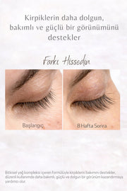 Kaş Kirpik Bakım Serumu – Gürleştirme, Uzatma ve Besleyici Serum Seti 13ml