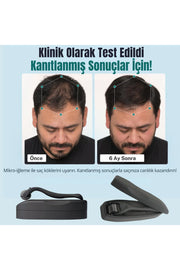 Titanyum Uçlu 540 İğneli Saç Sakal Çıkarma Ve Cilt Bakım Dermarolleri 1 mm