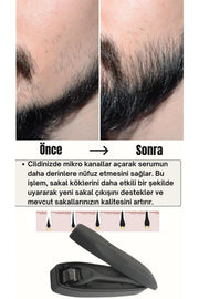 Saç Sakal Oluşumuna Yardımcı Serum Seti Besleyici Ve Dolgunlaştırıcı Serum