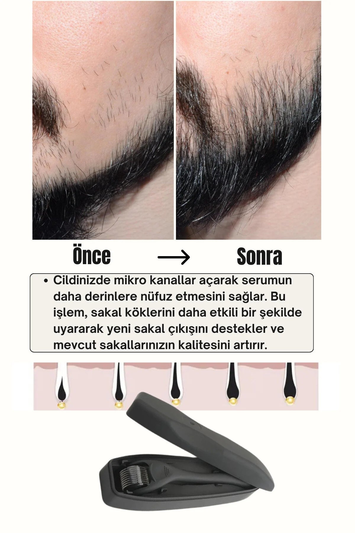 Seyrek Saç Sakal Serumu Ve 540 İğneli Dermaroller 1 mm Dezenfektan Seti