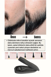 Seyrek Saç Sakal Serumu Ve 540 İğneli Dermaroller 1 mm Dezenfektan Seti